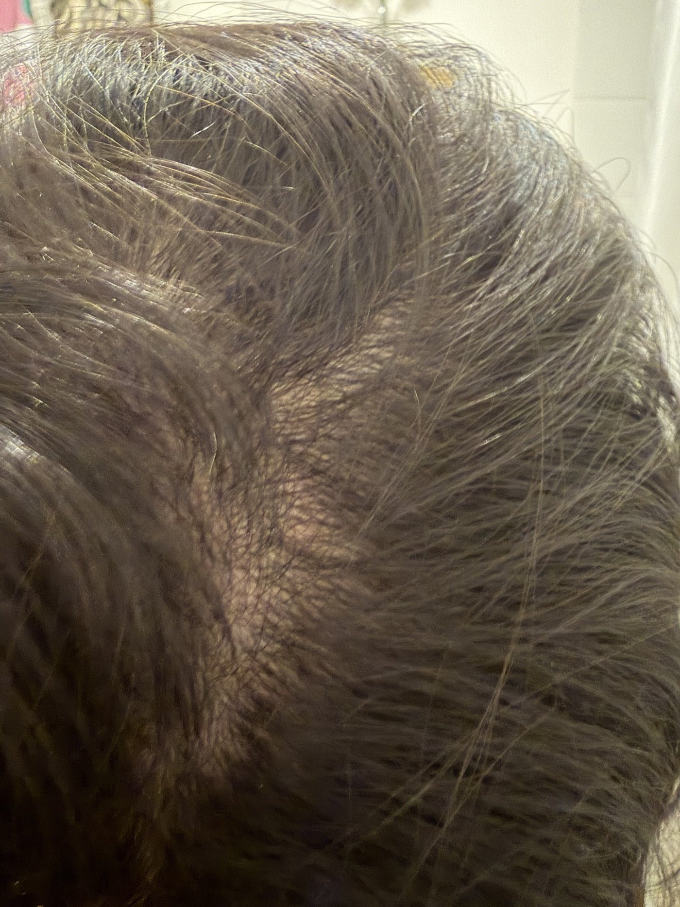 After